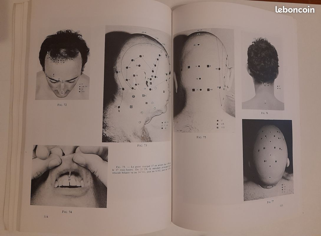 Atlas didactique d’acupuncture traditionnelle – 2e édition revue et corrigée (image 2)