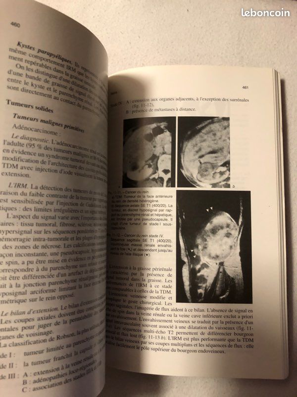Livre Imagerie par Résonance Magnétique (image 4)