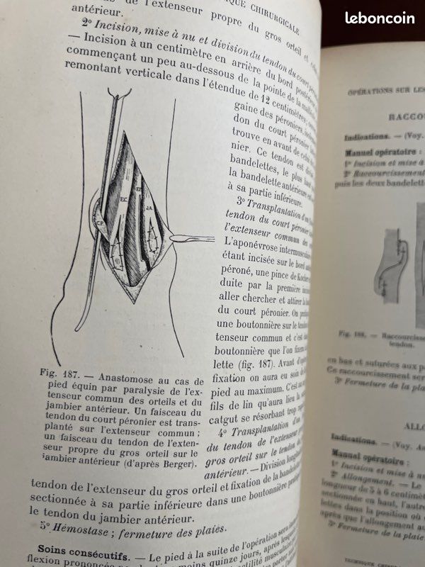 Livre ancien de 1908 « Manuel de Technique Chirurgicale » (image 6)