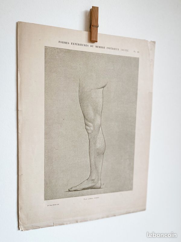 Formes extérieures Jambe #4 - Gravure ancienne originale d'anatomie - Dr.Richer (1890) - PL 86 (image 5)
