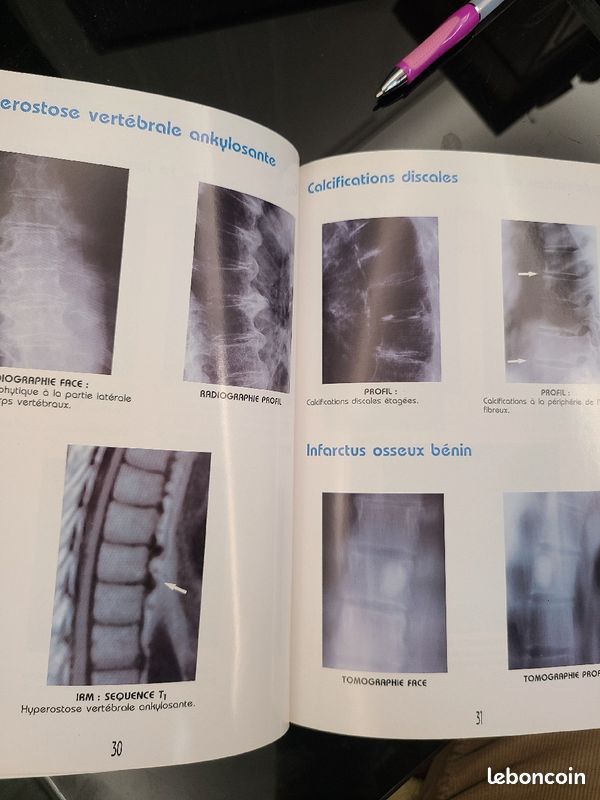 Livre radiologie : "atlas d'imagerie du rachis" . R Ghozlan (image 4)