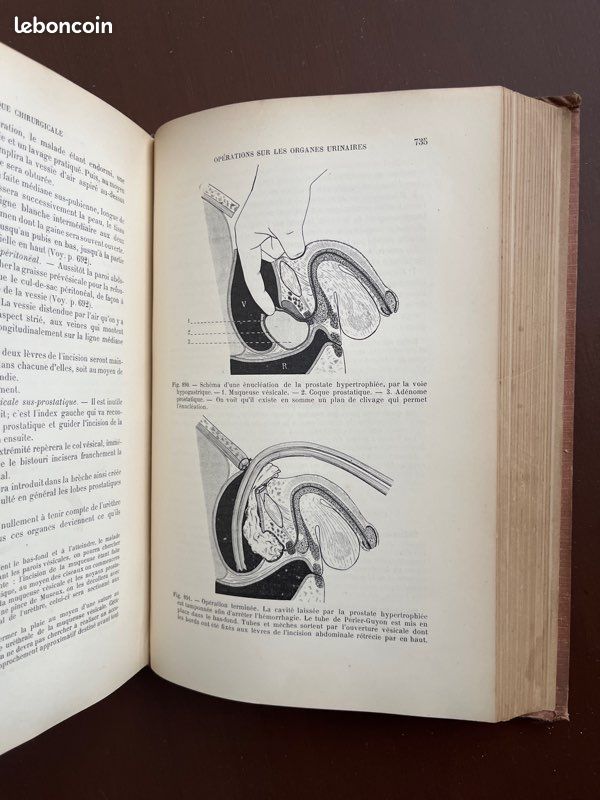 Livre ancien de 1908 « Manuel de Technique Chirurgicale » (image 9)