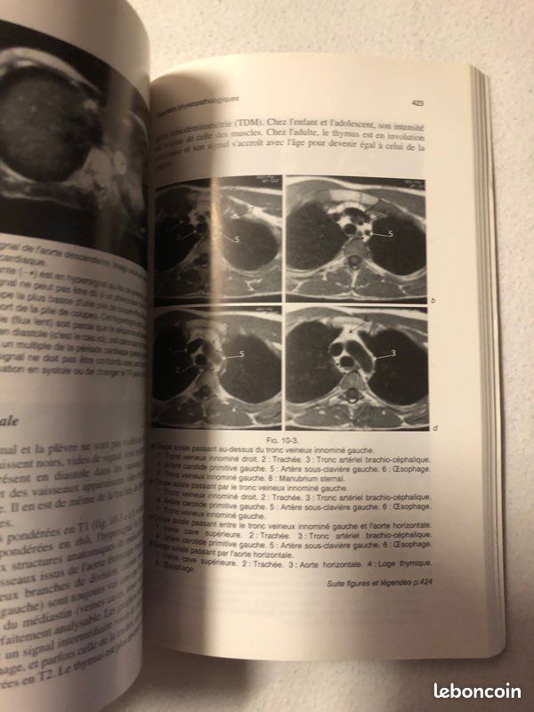 Livre Imagerie par Résonance Magnétique (image 5)