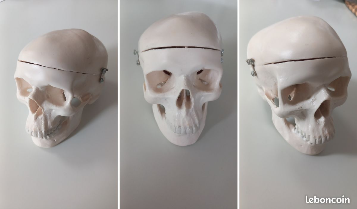 Réplique De Crâne Humain Réaliste En Résine - Modèle Médical - Neuf