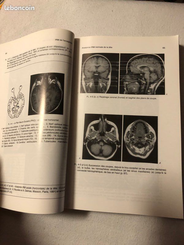 Livre Imagerie par Résonance Magnétique (image 3)