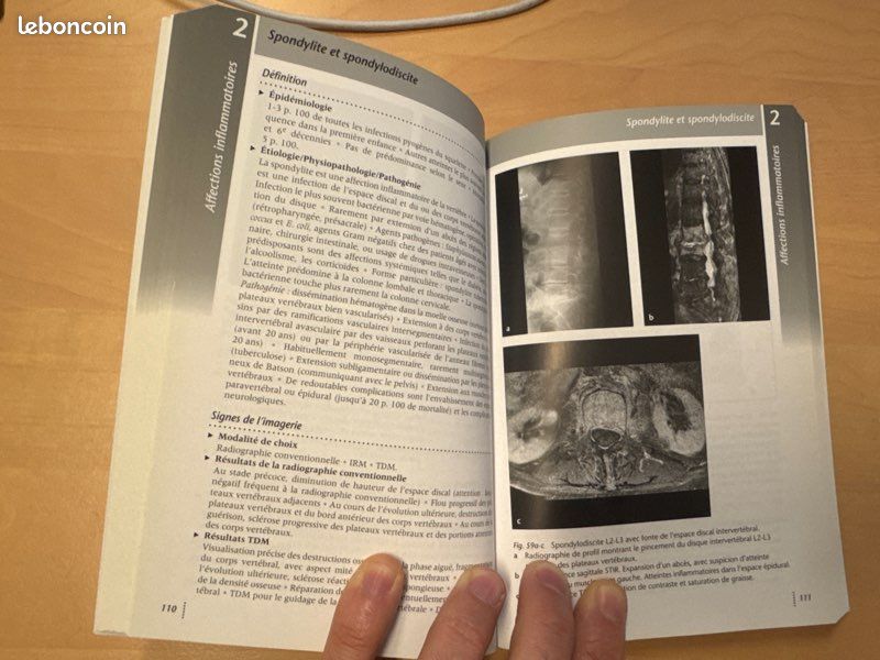 Livre Radiologie Ostéo-articulaire (image 3)