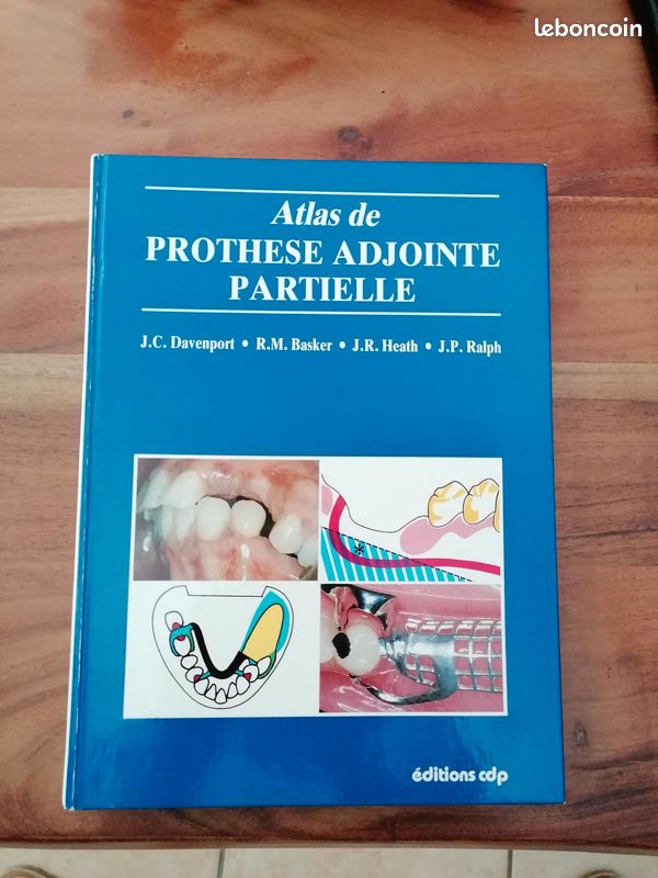 Atlas de prothèse adjointe partielle (image 1)