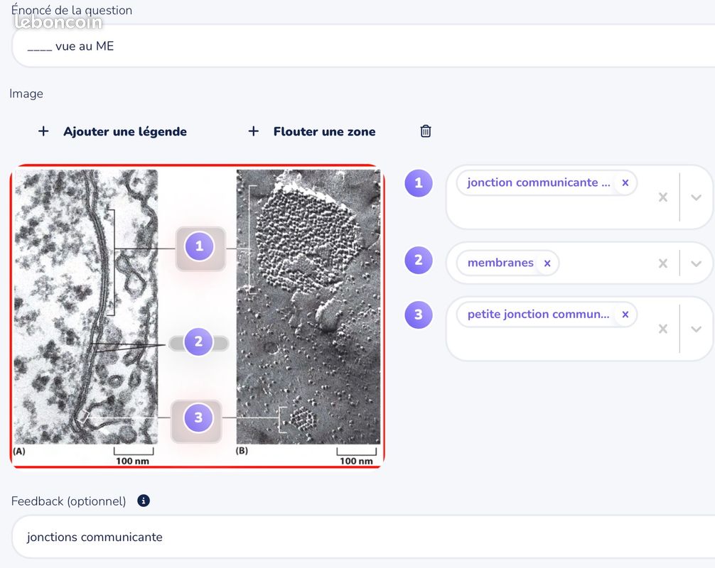 Flashcards d’Histologie humaine - 1ère année de médecine - PASS (Université de Rouen Normandie) (image 3)