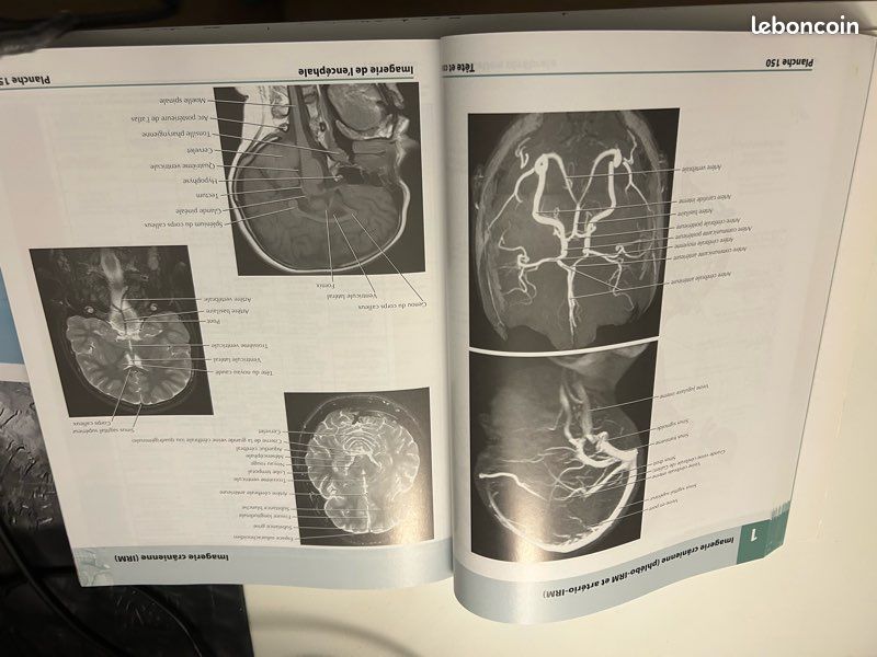 Atlas d’anatomie humaine 6 eme édition . Franck H. Netter MD (image 7)