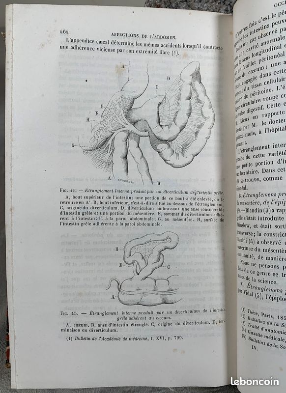 Livre Ancien : Traité D'anatomie Médico-chirurgicale Par Pétrequin - Édition Originale 1844 - Reliure Demi-cuir